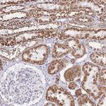 PDCD7 Antibody in Immunohistochemistry (Paraffin) (IHC (P))