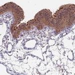 Naked1 Antibody in Immunohistochemistry (Paraffin) (IHC (P))