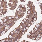 Naked1 Antibody in Immunohistochemistry (Paraffin) (IHC (P))