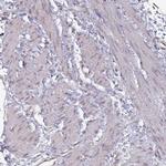 Naked1 Antibody in Immunohistochemistry (IHC)