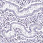 MIDN Antibody in Immunohistochemistry (Paraffin) (IHC (P))