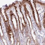 MIDN Antibody in Immunohistochemistry (Paraffin) (IHC (P))