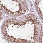 POLR3F Antibody in Immunohistochemistry (IHC)