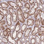 SLC25A42 Antibody in Immunohistochemistry (Paraffin) (IHC (P))