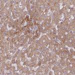 Adenylate Kinase 4 Antibody in Immunohistochemistry (Paraffin) (IHC (P))