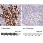 Adenylate Kinase 4 Antibody in Immunohistochemistry (IHC)