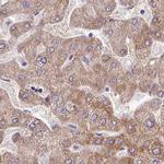 Adenylate Kinase 4 Antibody in Immunohistochemistry (IHC)