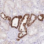 Naked2 Antibody in Immunohistochemistry (Paraffin) (IHC (P))