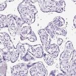 Podocin Antibody in Immunohistochemistry (Paraffin) (IHC (P))