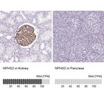 Podocin Antibody in Immunohistochemistry (IHC)