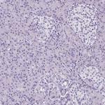 Podocin Antibody in Immunohistochemistry (IHC)