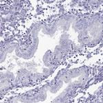 HAO1 Antibody in Immunohistochemistry (Paraffin) (IHC (P))