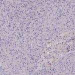 HAO1 Antibody in Immunohistochemistry (IHC)