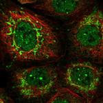 PUS10 Antibody in Immunocytochemistry (ICC/IF)