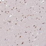 PUS10 Antibody in Immunohistochemistry (Paraffin) (IHC (P))