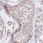 PUS10 Antibody in Immunohistochemistry (Paraffin) (IHC (P))