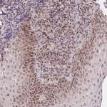 PUS10 Antibody in Immunohistochemistry (Paraffin) (IHC (P))