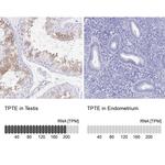 PTEN2 Antibody in Immunohistochemistry (IHC)