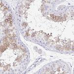 PTEN2 Antibody in Immunohistochemistry (IHC)