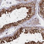 BAP29 Antibody in Immunohistochemistry (IHC)