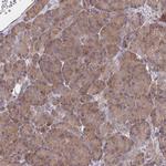 BAP29 Antibody in Immunohistochemistry (IHC)