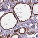 BAP29 Antibody in Immunohistochemistry (IHC)