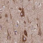 BAP29 Antibody in Immunohistochemistry (IHC)