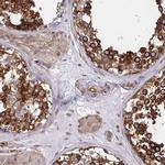 BAP29 Antibody in Immunohistochemistry (IHC)