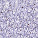 HERC1 Antibody in Immunohistochemistry (Paraffin) (IHC (P))