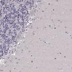 R9BP Antibody in Immunohistochemistry (Paraffin) (IHC (P))