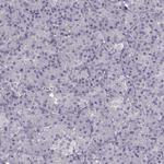 R9BP Antibody in Immunohistochemistry (Paraffin) (IHC (P))