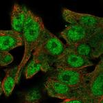 SALL1 Antibody in Immunocytochemistry (ICC/IF)