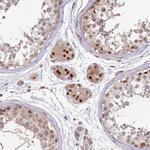 SALL1 Antibody in Immunohistochemistry (Paraffin) (IHC (P))