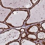 SALL1 Antibody in Immunohistochemistry (IHC)