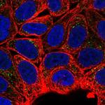 MTMR2 Antibody in Immunocytochemistry (ICC/IF)