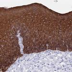 MTMR2 Antibody in Immunohistochemistry (Paraffin) (IHC (P))