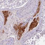 NTN4 Antibody in Immunohistochemistry (Paraffin) (IHC (P))