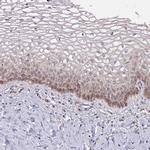 MAGT1 Antibody in Immunohistochemistry (IHC)