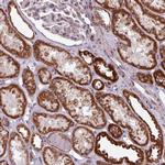 MAGT1 Antibody in Immunohistochemistry (IHC)