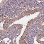 MAGT1 Antibody in Immunohistochemistry (IHC)