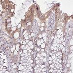 CCL1 Antibody in Immunohistochemistry (Paraffin) (IHC (P))