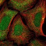 ZNF14 Antibody in Immunocytochemistry (ICC/IF)