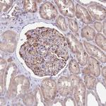 ZNF14 Antibody in Immunohistochemistry (Paraffin) (IHC (P))