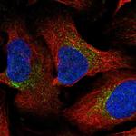 GAL Antibody in Immunocytochemistry (ICC/IF)