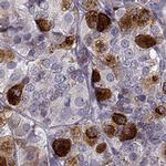 GAL Antibody in Immunohistochemistry (IHC)