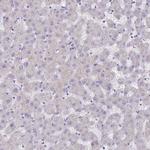 DDHD1 Antibody in Immunohistochemistry (Paraffin) (IHC (P))