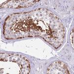 DDHD1 Antibody in Immunohistochemistry (Paraffin) (IHC (P))