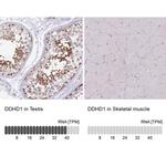 DDHD1 Antibody in Immunohistochemistry (IHC)