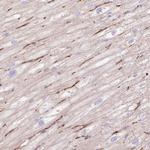 EHD3 Antibody in Immunohistochemistry (Paraffin) (IHC (P))