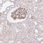 EHD3 Antibody in Immunohistochemistry (Paraffin) (IHC (P))